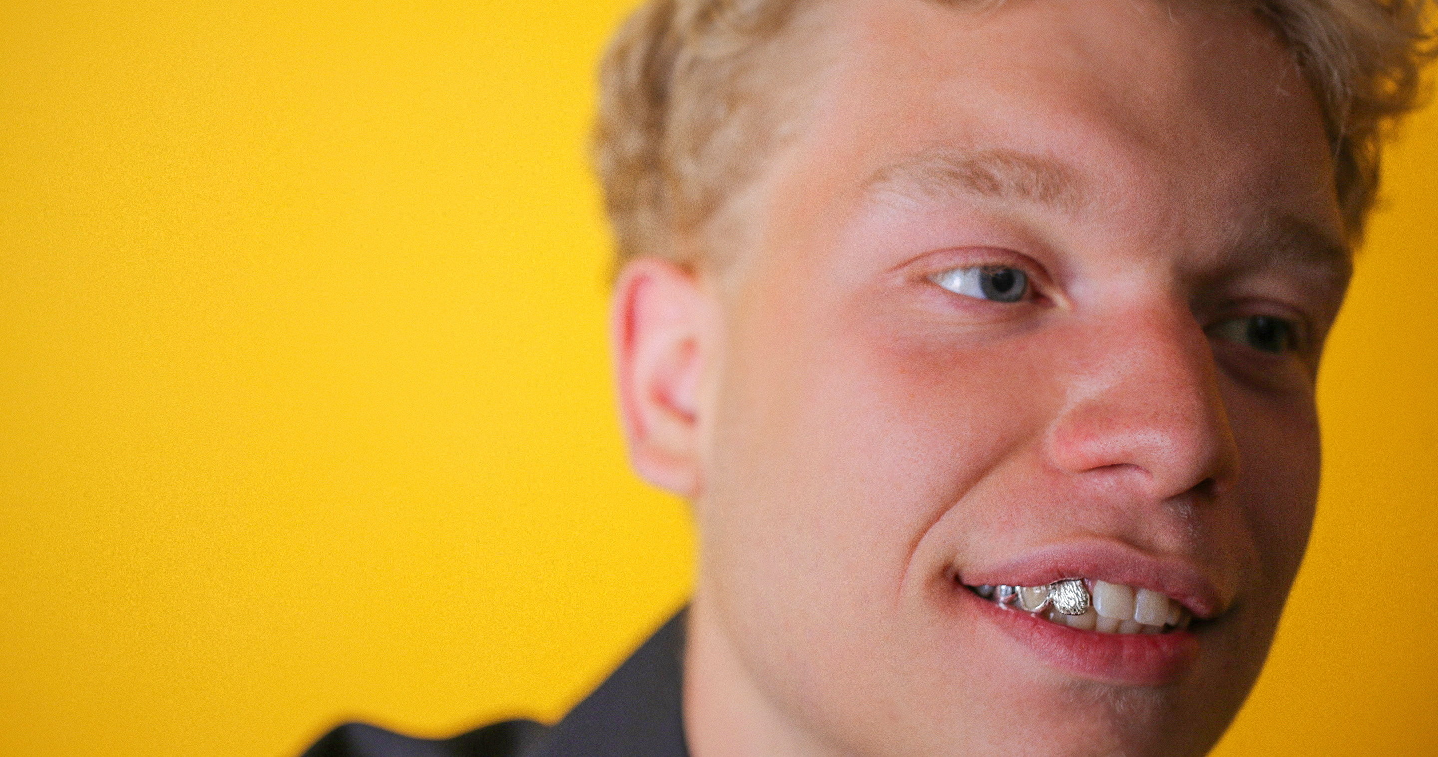 Juice Grillz model bærer custom grillz